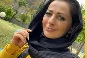 راز چاقی صورت نفیسه روشن بدون عمل زیبایی