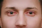این غذاها باعث افزایش فشار چشم می‌شوند!