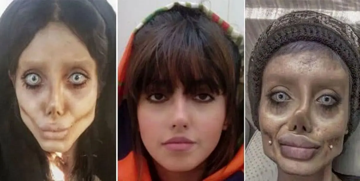 ابتلای سحر تبر به کرونا و بستری شدن در بیمارستان سینا
