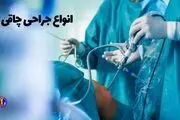 افشای رایج‌ترین عمل‌های زیبایی ایران