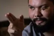 کشتن و کور کردن؛ پاسخ پلیس آمریکا به معترضان
