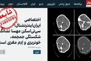 اعتراف براندازان به دروغ بودن ضرب‌وشتم مهسا امینی