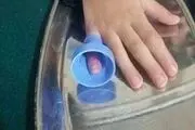 
بازی کودکانه دردسرساز شد + تصاویر
