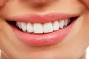 راهکارهای اصولی برای جلوگیری از پوسیدگی دندان در نوروز