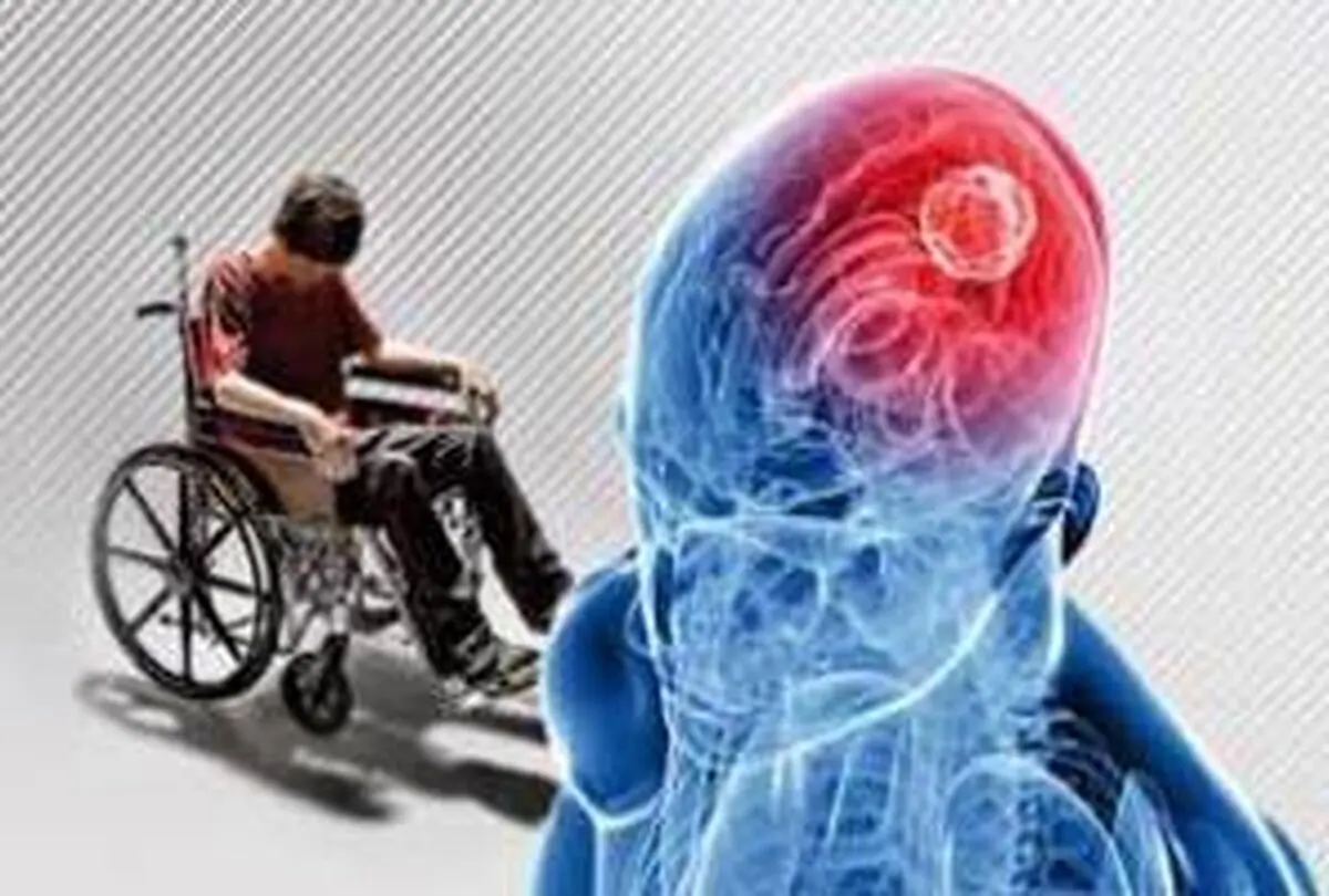 رژیم غذایی در کنترل بیماری ام اس چه نقشی دارد؟