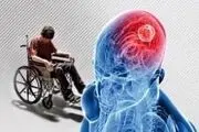شناسایی بیماری ام اس و نشانه های آن