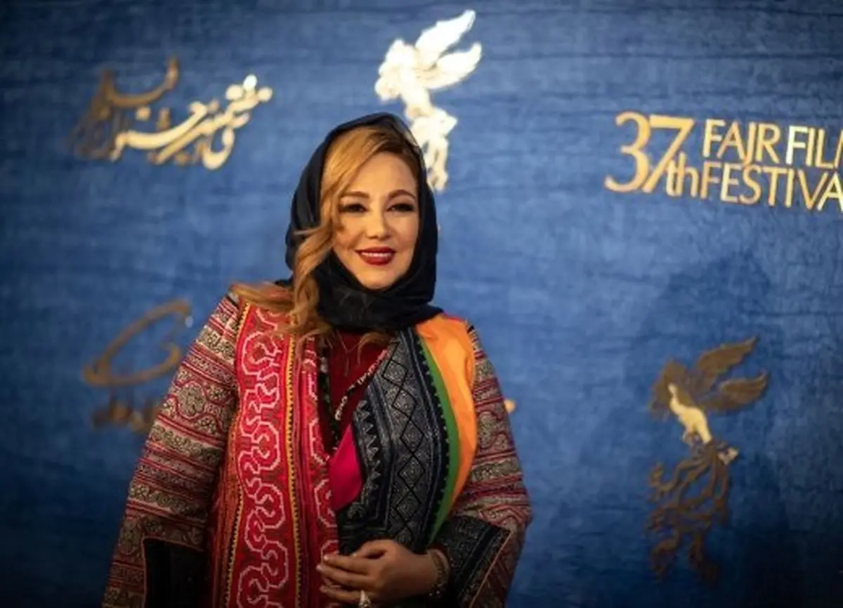 «بهنوش بختیاری» بازهم تغییر چهره داد/ عکس