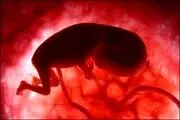 آمار وحشتناک سقط جنین؛ سقط در خانه ۳۰ میلیون!
