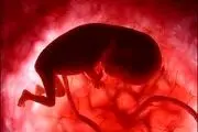 سقط جنین زن باردار در حمله دو کیف قاپ
