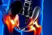شایع‌ترین دلایل ایجاد درد‌های لگنی در بانوان چیست؟

