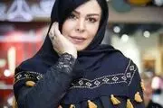 عکسی شوکه کننده از فلور نظری | تغییر چهره فلور نظری