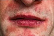 این علامت روی پوست خبرهای بدی دارد!