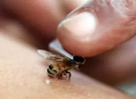 این افراد نباید زنبور درمانی کنند