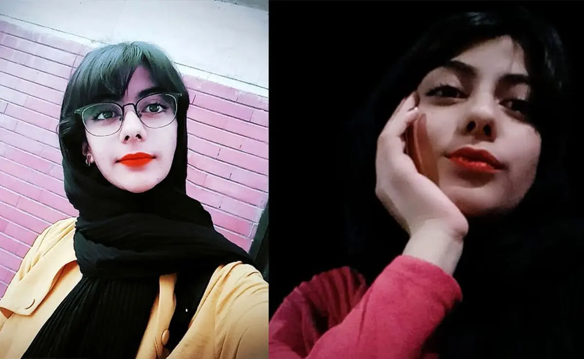 مرگ عجیب خانم مجری جوان بخاطر جوش صورت!
