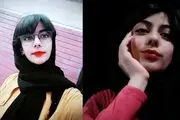 مرگ عجیب خانم مجری جوان بخاطر جوش صورت!
