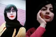 مرگ عجیب خانم مجری جوان بخاطر جوش صورت!
