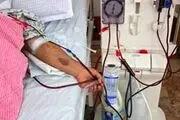 واکنش وزیر بهداشت به فوت ناگهانی 70 بیمار دیالیزی