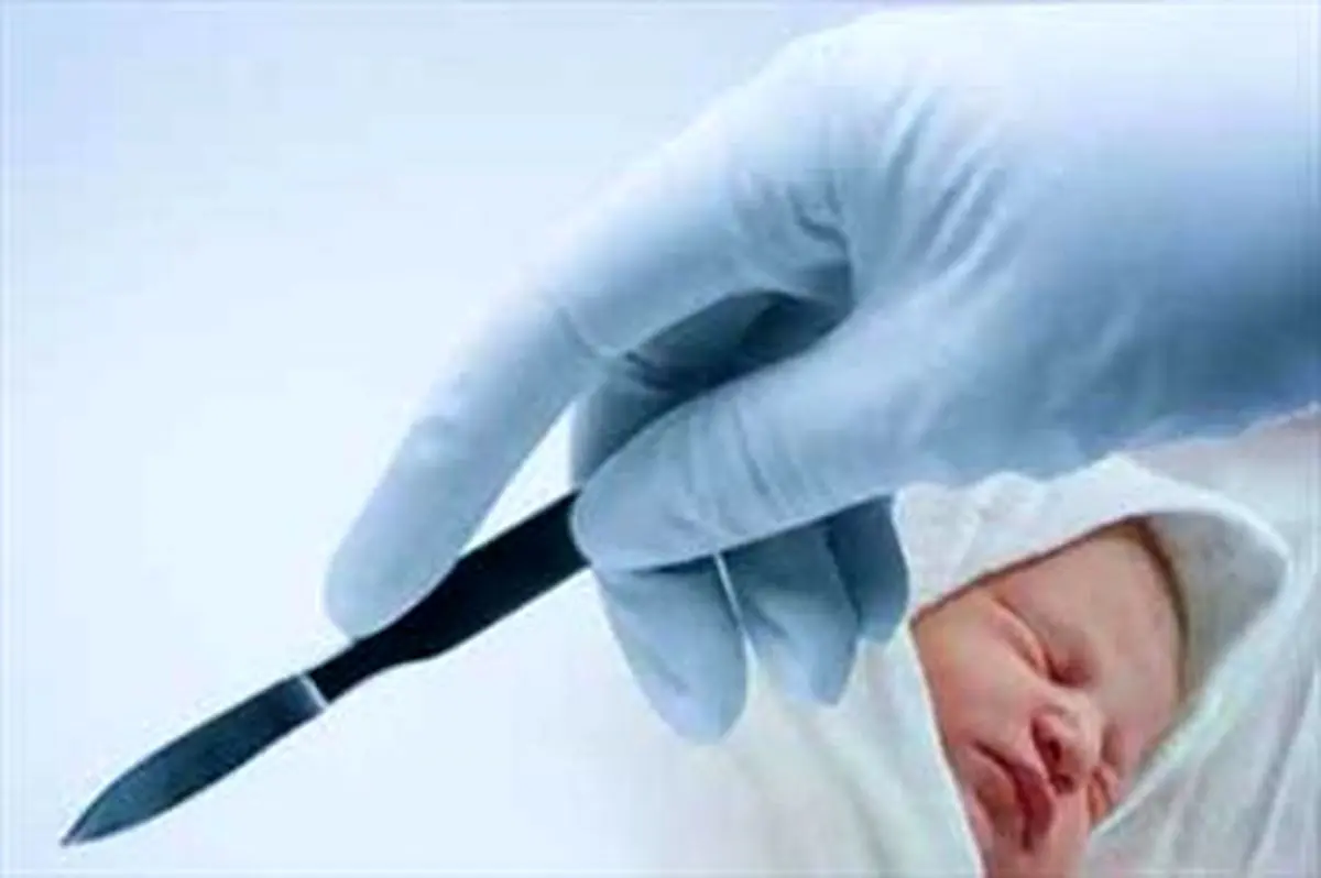 چرایی افزایش آمار سزارین