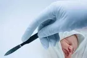  چرایی افزایش آمار سزارین