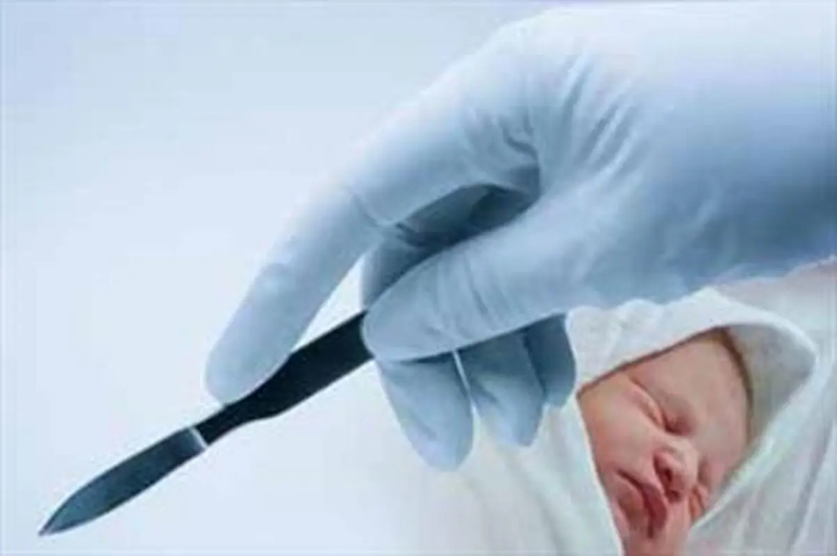  چرایی افزایش آمار سزارین