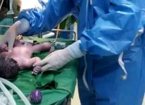 
تولد نخستین نوزاد مبتلا به کرونا در مشهد
