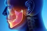چه زمانی به جراح فک و صورت مراجعه کنیم؟
