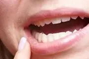  گاهی آفت خبر از سرطان می دهد! 