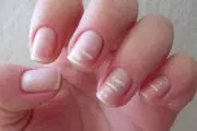 وقت مناسب ناخن گیری از نظر علم پزشکی