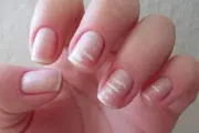 وقت مناسب ناخن گیری از نظر علم پزشکی
