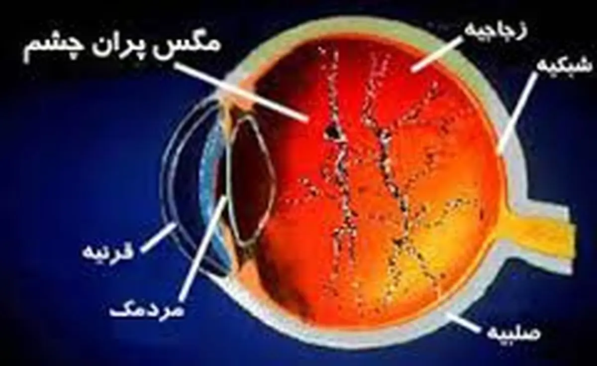 مگس پران چشم را جدی بگیرید