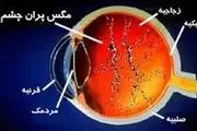 مگس پران چشم را جدی بگیرید