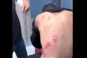 آثار شکنجه بر بدن زندانیان سابق اردوگاه جنین/فیلم