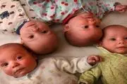 آمار چند قلو زایی سال 98 در ایران