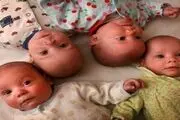 آمار چند قلو زایی سال 98 در ایران