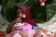خطر مرگ ۱۷۰ بیمار دیالیزی یمنی در اثر محاصره عربستان
