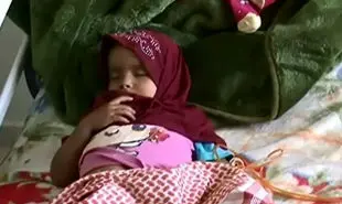 خطر مرگ ۱۷۰ بیمار دیالیزی یمنی در اثر محاصره عربستان