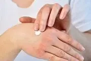 چرا پوستمان خشک می‌شود؟
