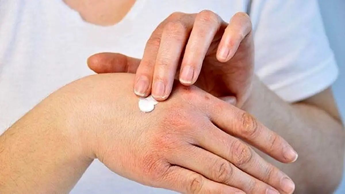 چرا پوستمان خشک میشود؟