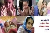 تولد افراد زیر 60 سانتی متر در ایران!