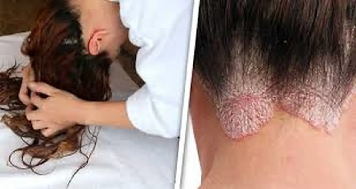 اگر با موی خیس بخوابید، به این بیماری مبتلا میشوید