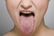 کدام موادغذایی دهانتان را خشک می‌کند؟