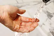 بایدها و نبایدهایی در زمان رسیدگی به یک زخم