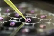 درمان نارسایی کلیه با سلولهای بنیادی