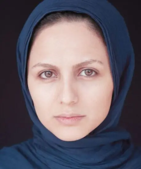 چهره سرخ شده‌ی نیلوفر کوخانی /عکس