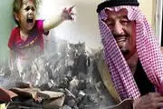 اظهارات فعال انگلیسی درباره جنایت‌های عربستان سعودی علیه مردم یمن