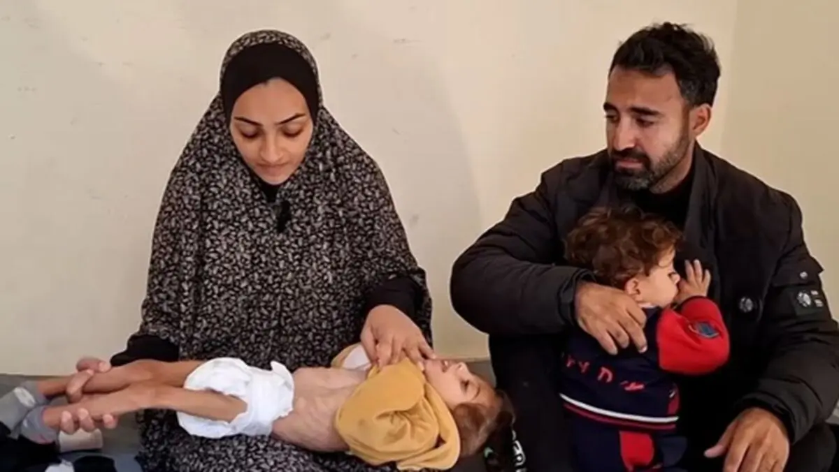 سوء‌تغذیه با کودکان غزه چه می‌کند؟