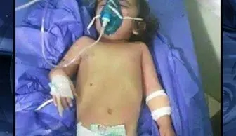 مرگ دختر عراقی در حمله شیمیایی داعش
