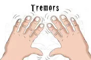 دلیل لرزش دست چیست؟