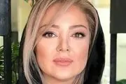 علت تغییر چهره رزیتا غفاری