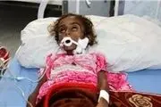 وضعیت یمن اسفناک تر از اهالی روهینگیاست 